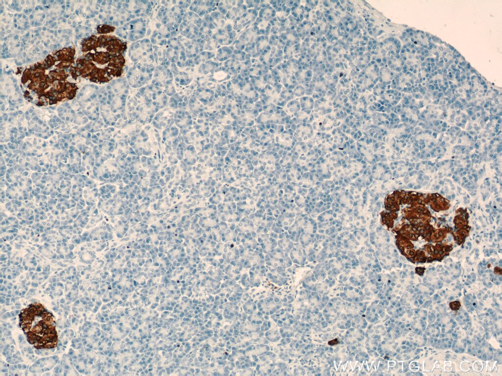 INS Polyclonal antibody