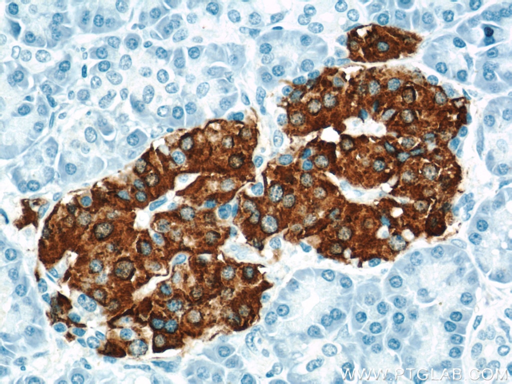 Immunohistochemistry (IHC) staining of human pancreas tissue using INS Polyclonal antibody (15848-1-AP)