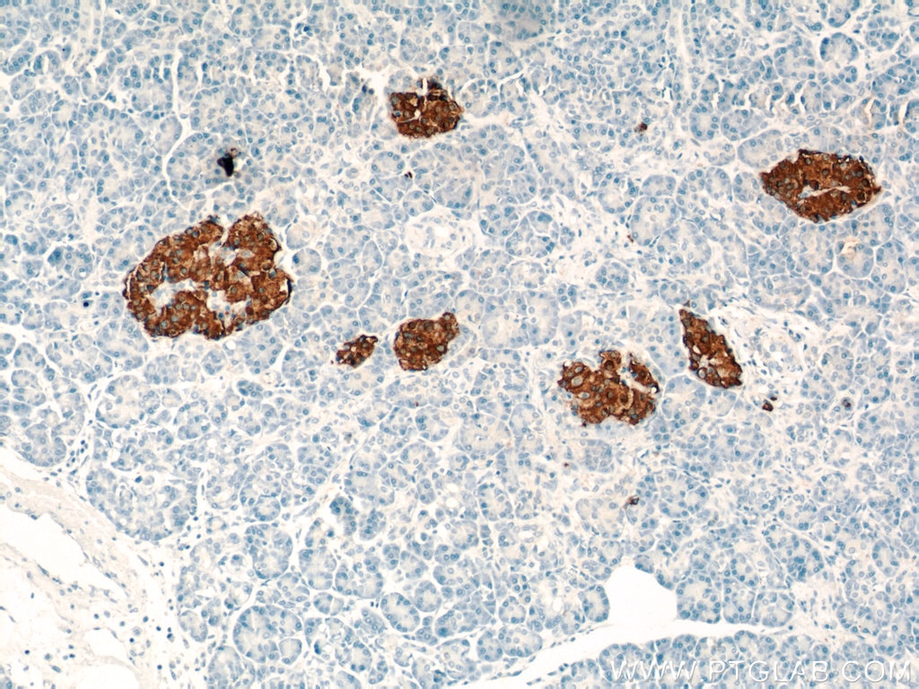 Immunohistochemistry (IHC) staining of human pancreas tissue using INS Polyclonal antibody (15848-1-AP)