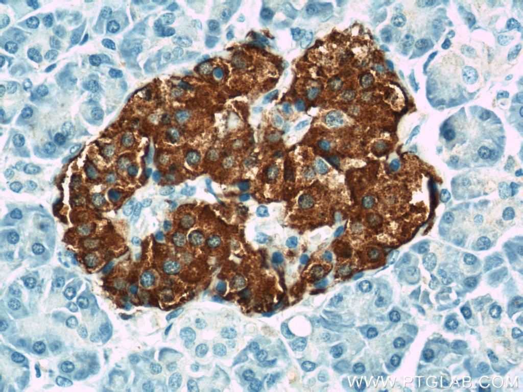 IHC staining of human pancreas using 15848-1-AP