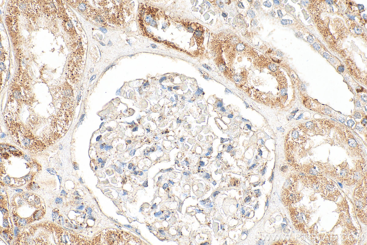 Immunohistochemistry (IHC) staining of human kidney tissue using INSC Polyclonal antibody (20973-1-AP)