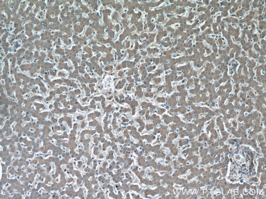 IHC staining of human liver using 20973-1-AP