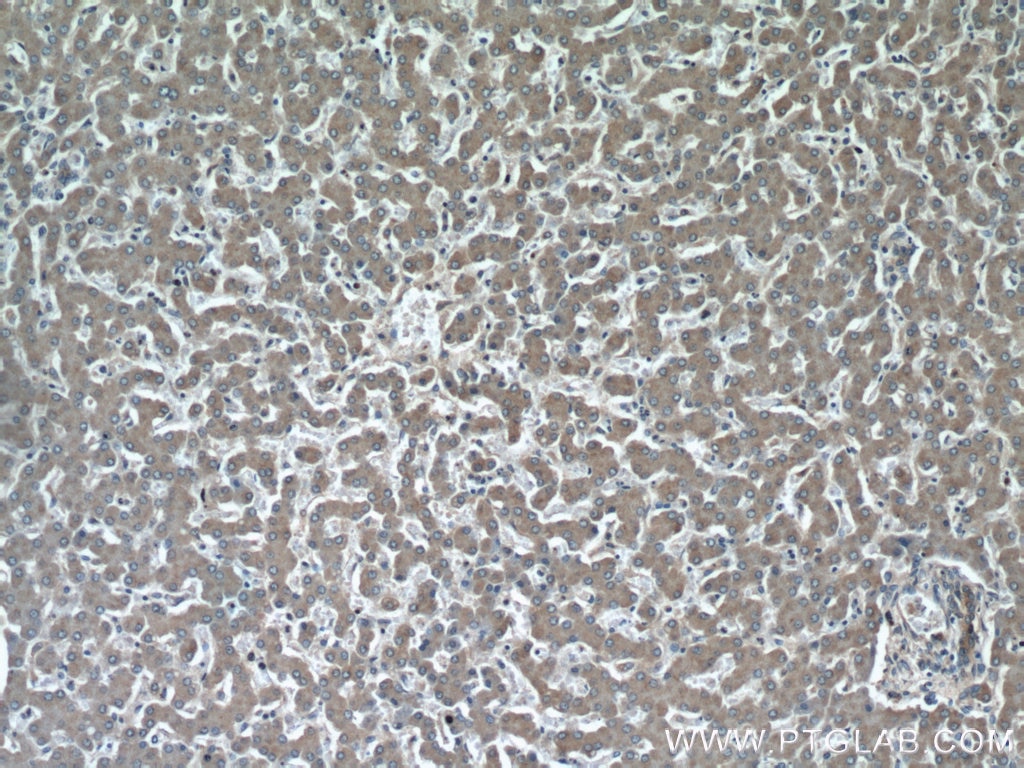 Immunohistochemistry (IHC) staining of human liver tissue using INSC Polyclonal antibody (20973-1-AP)