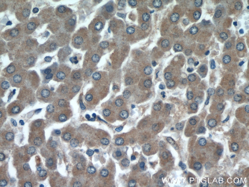 Immunohistochemistry (IHC) staining of human liver tissue using INSC Polyclonal antibody (20973-1-AP)