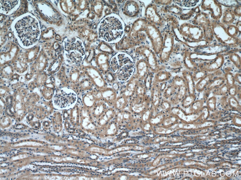 Immunohistochemistry (IHC) staining of human kidney tissue using INSC Polyclonal antibody (20973-1-AP)