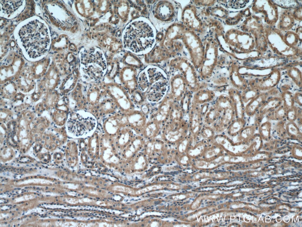 Immunohistochemistry (IHC) staining of human kidney tissue using INSC Polyclonal antibody (20973-1-AP)