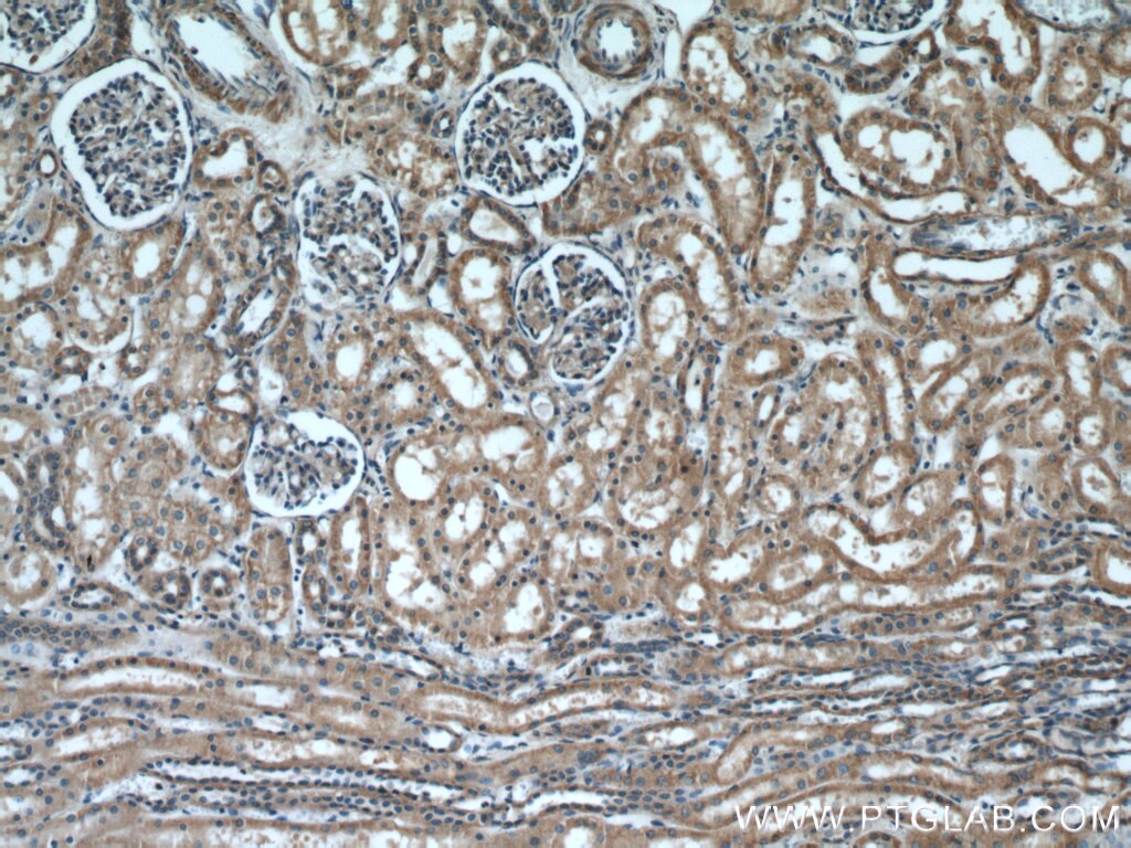 IHC staining of human kidney using 20973-1-AP