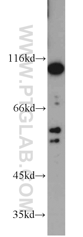 Western Blot (WB) analysis of mouse kidney tissue using INSC Polyclonal antibody (20973-1-AP)