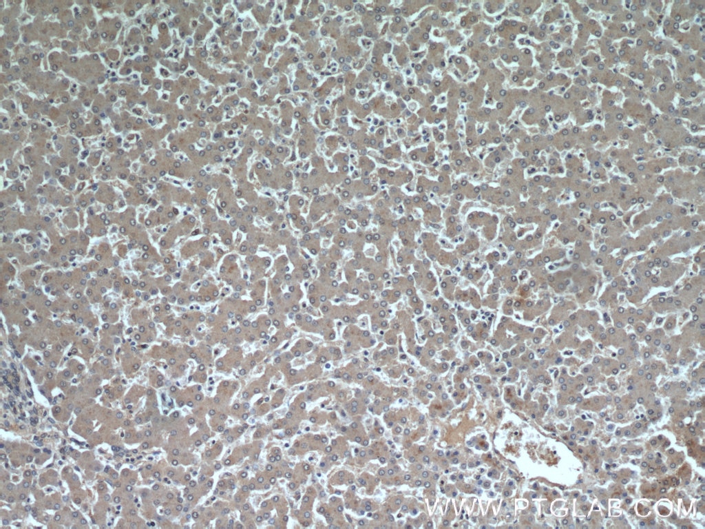 Immunohistochemistry (IHC) staining of human liver tissue using INSIG1 Polyclonal antibody (22115-1-AP)