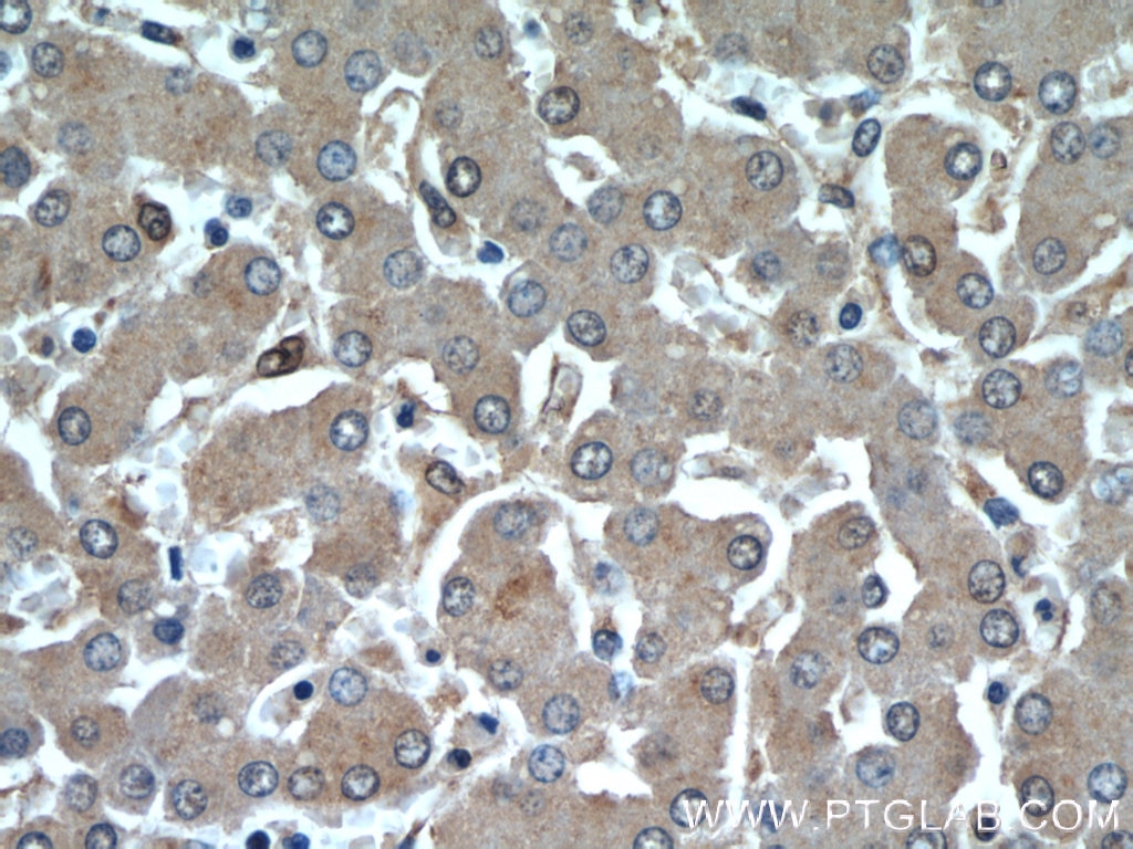 Immunohistochemistry (IHC) staining of human liver tissue using INSIG1 Polyclonal antibody (22115-1-AP)