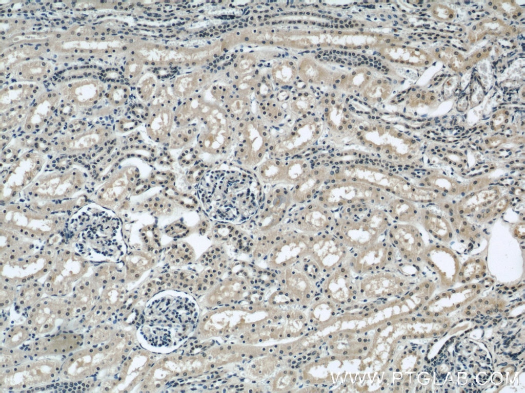 Immunohistochemistry (IHC) staining of human kidney tissue using INSIG1 Polyclonal antibody (22115-1-AP)