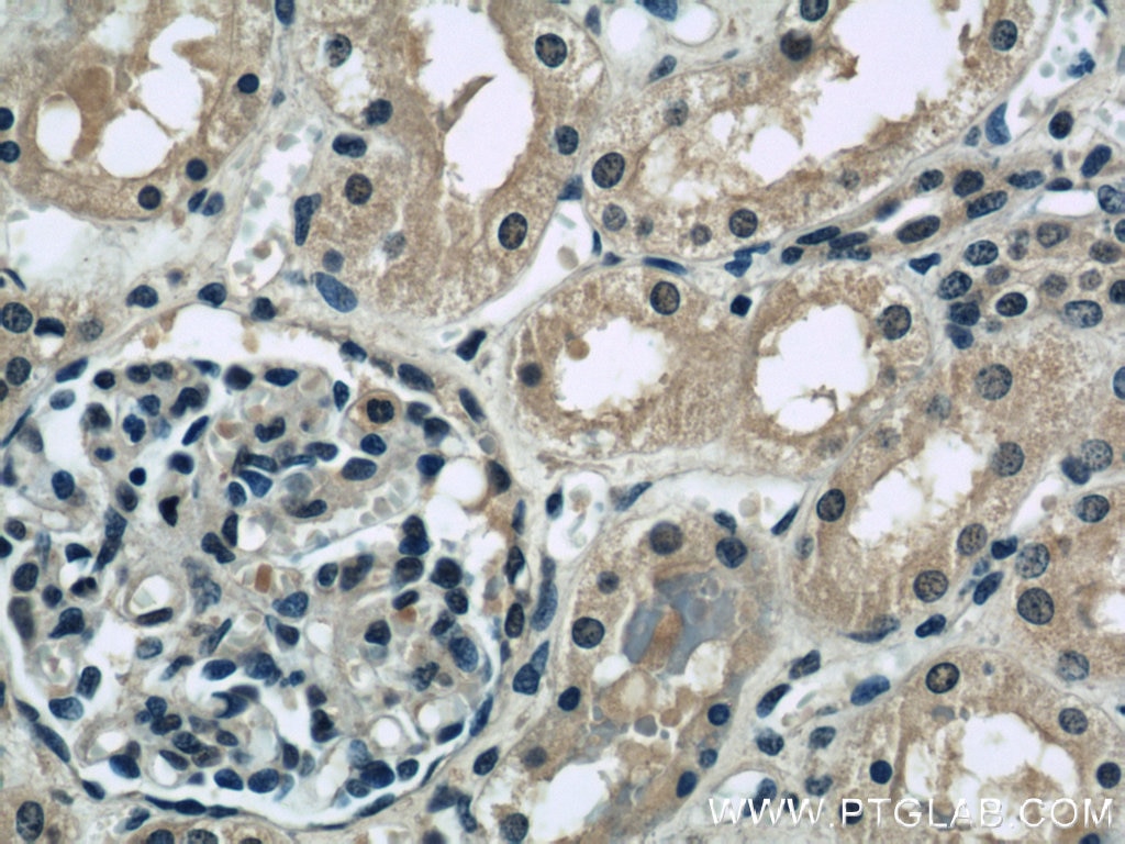 Immunohistochemistry (IHC) staining of human kidney tissue using INSIG1 Polyclonal antibody (22115-1-AP)