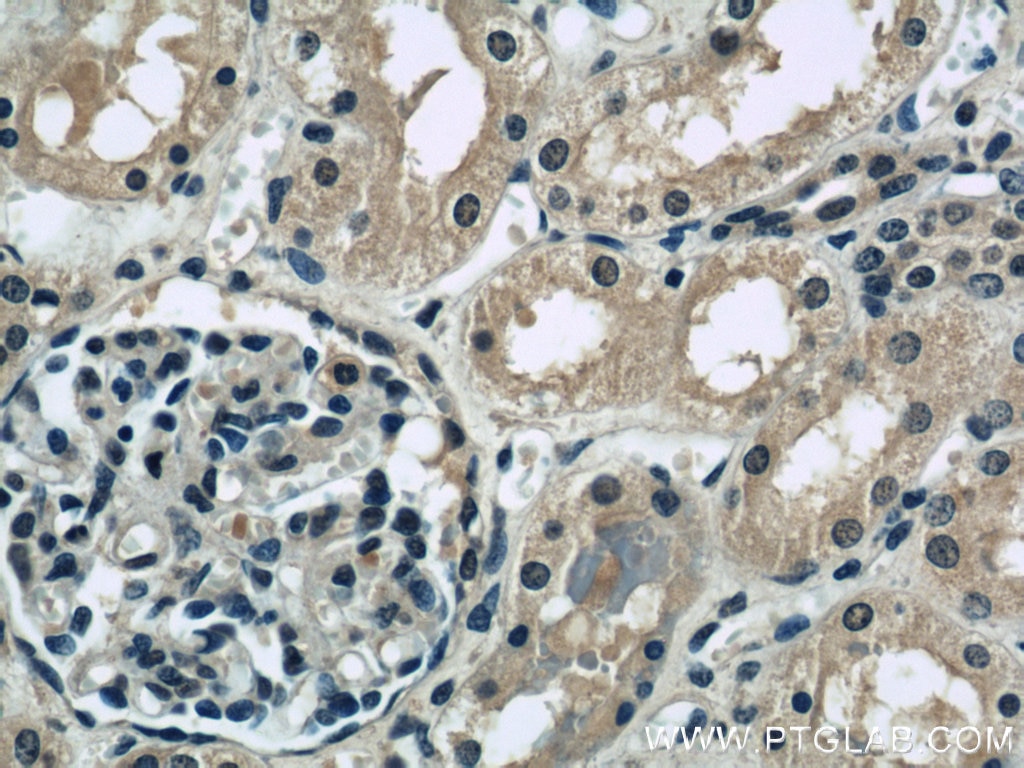 IHC staining of human kidney using 22115-1-AP