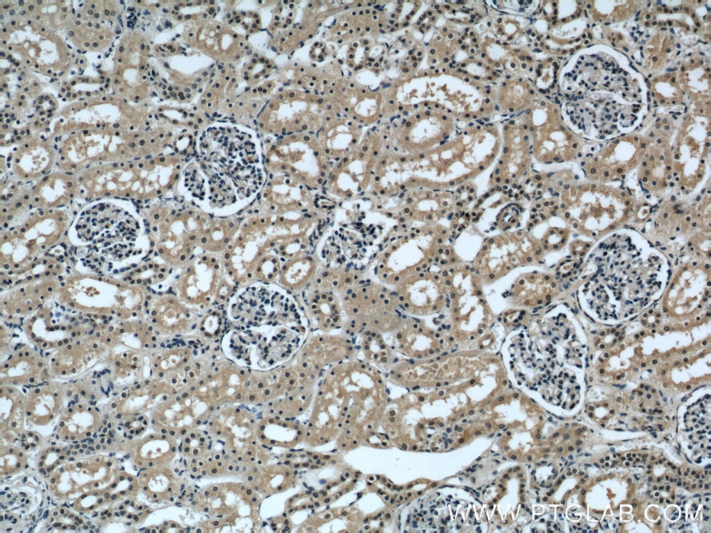 Immunohistochemistry (IHC) staining of human kidney tissue using INSIG1 Polyclonal antibody (22115-1-AP)