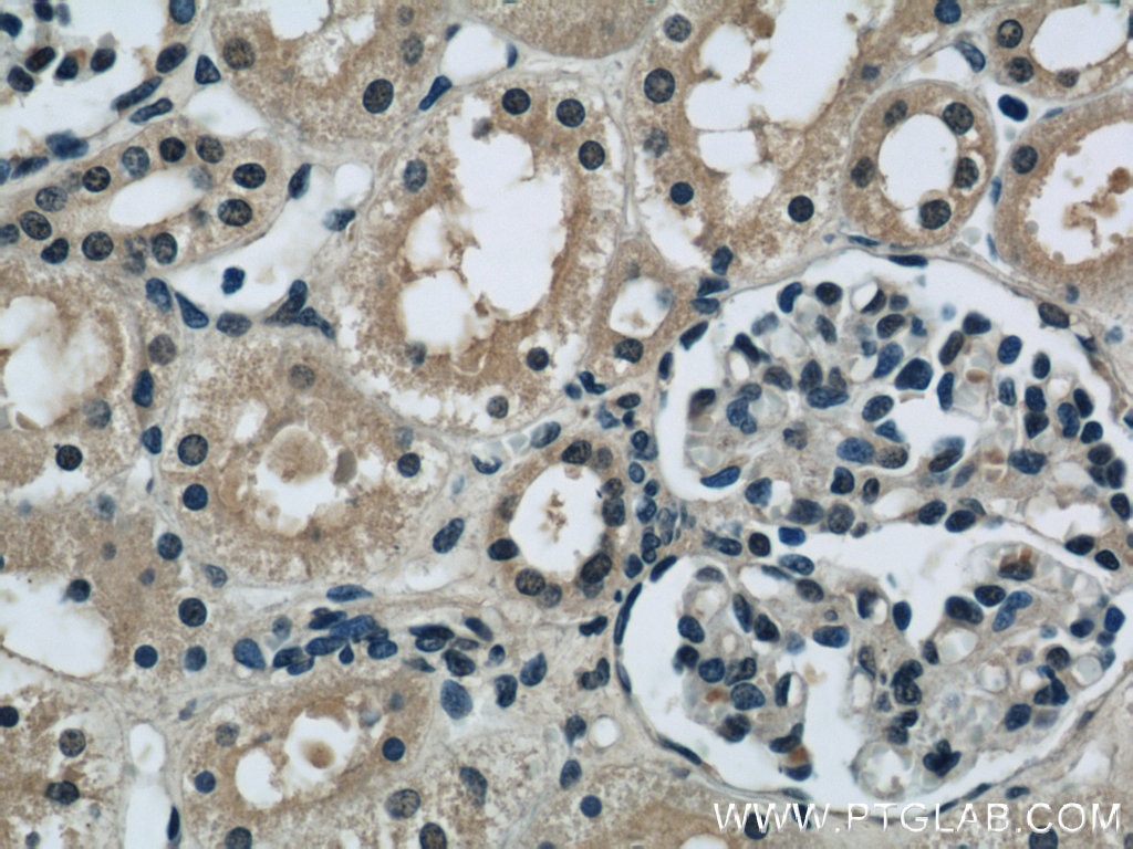 Immunohistochemistry (IHC) staining of human kidney tissue using INSIG1 Polyclonal antibody (22115-1-AP)