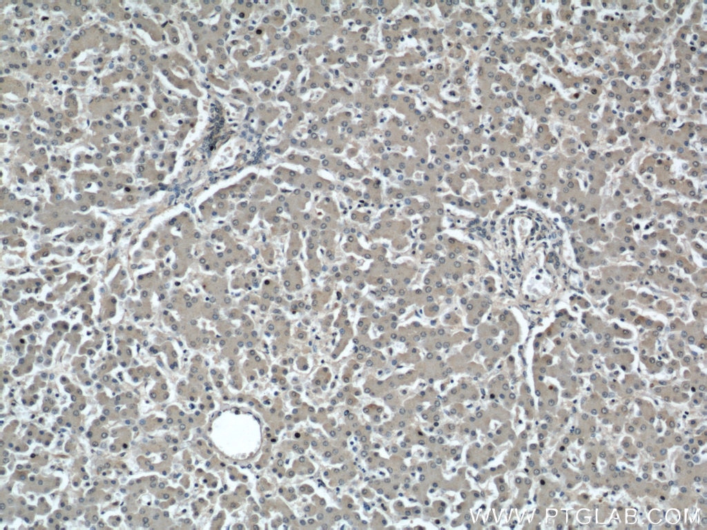Immunohistochemistry (IHC) staining of human liver tissue using INSIG1 Polyclonal antibody (22115-1-AP)