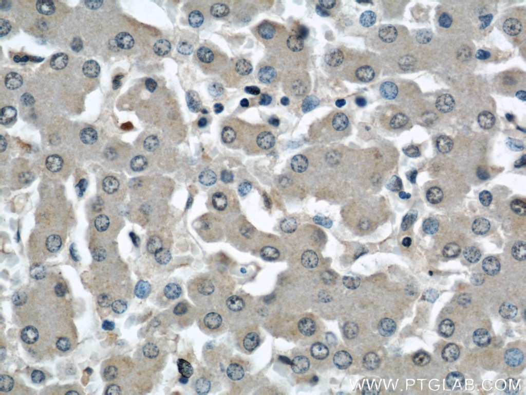 Immunohistochemistry (IHC) staining of human liver tissue using INSIG1 Polyclonal antibody (22115-1-AP)