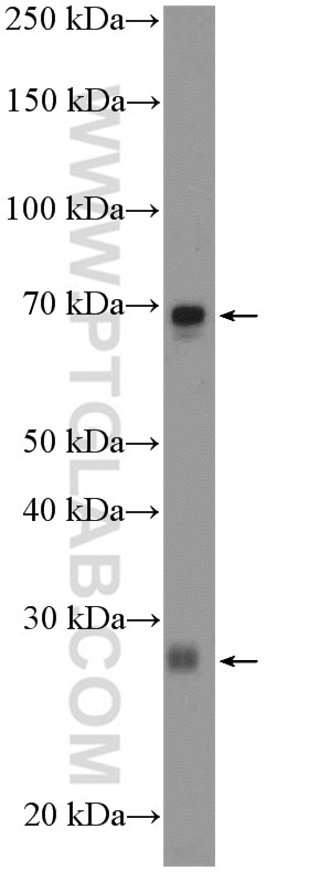 Western Blot (WB) analysis of SGC-7901 cells using INSIG1 Polyclonal antibody (22115-1-AP)