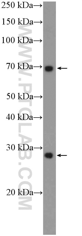 Western Blot (WB) analysis of A549 cells using INSIG1 Polyclonal antibody (22115-1-AP)