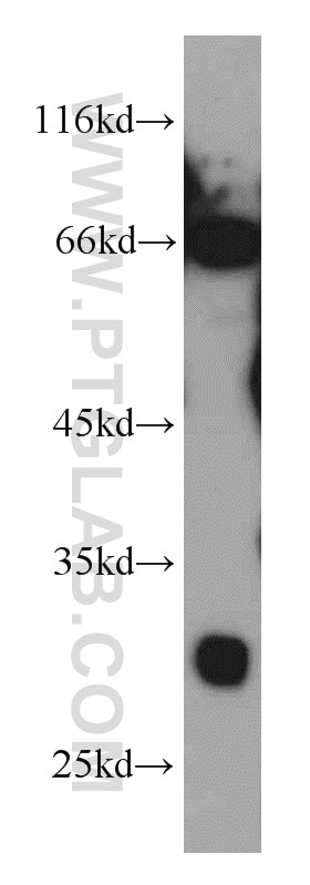 Western Blot (WB) analysis of A549 cells using INSIG1 Polyclonal antibody (22115-1-AP)