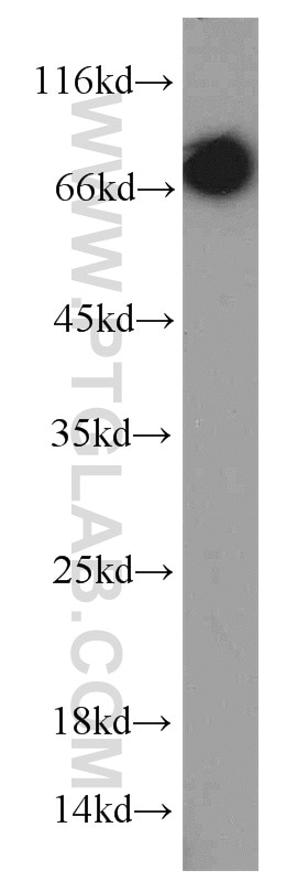 Western Blot (WB) analysis of MCF-7 cells using INSIG1 Polyclonal antibody (22115-1-AP)