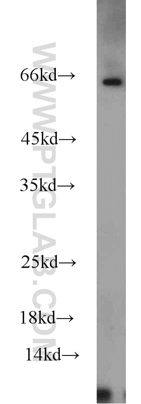 Western Blot (WB) analysis of HepG2 cells using INSIG1 Polyclonal antibody (22115-1-AP)