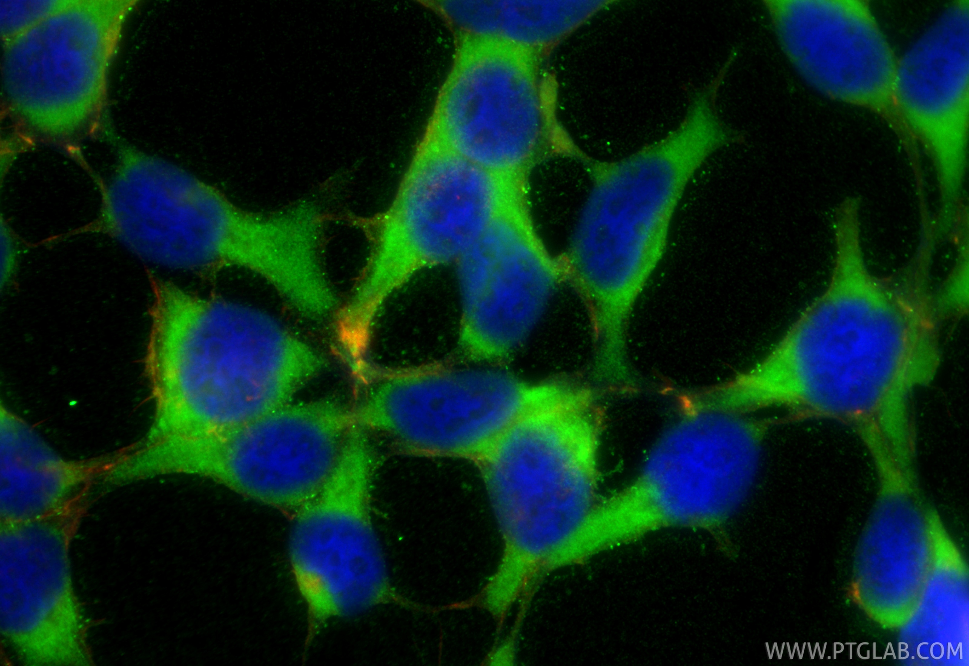 Immunofluorescence (IF) / fluorescent staining of HEK-293 cells using INSIG1 Polyclonal antibody (55282-1-AP)