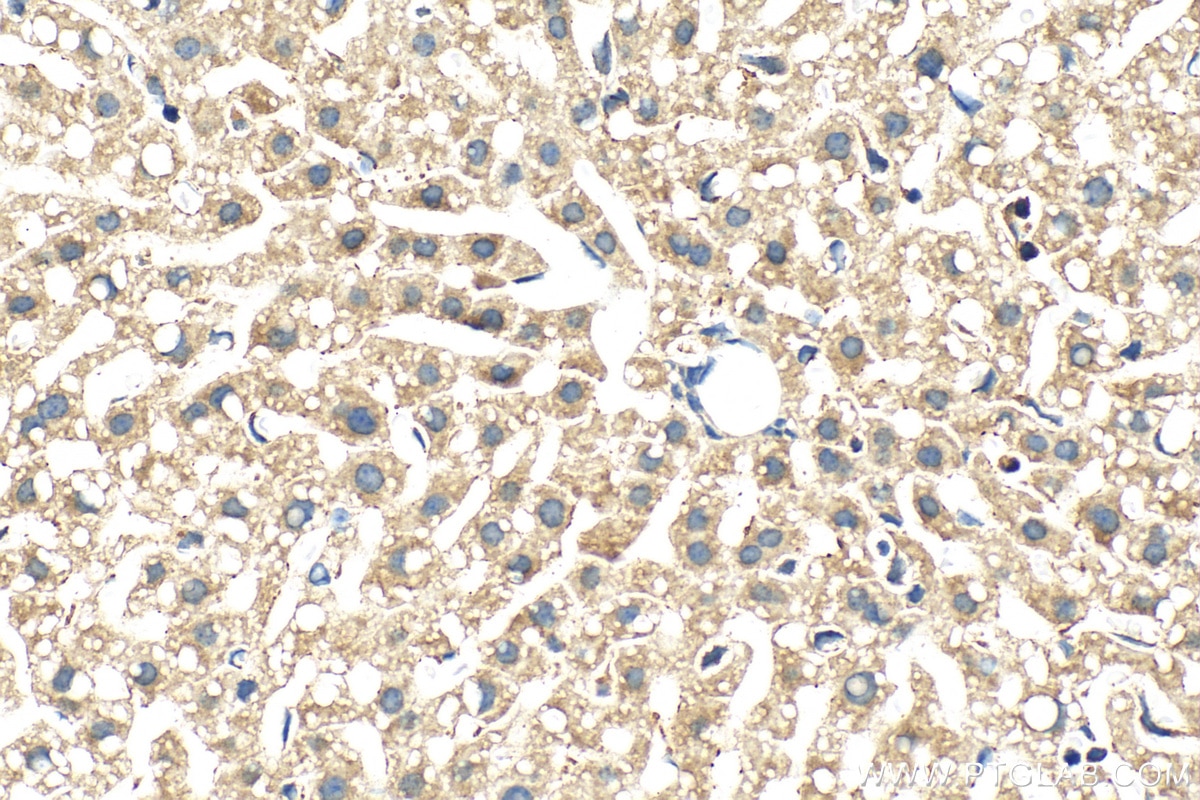 Immunohistochemistry (IHC) staining of mouse liver tissue using INSIG1 Polyclonal antibody (55282-1-AP)
