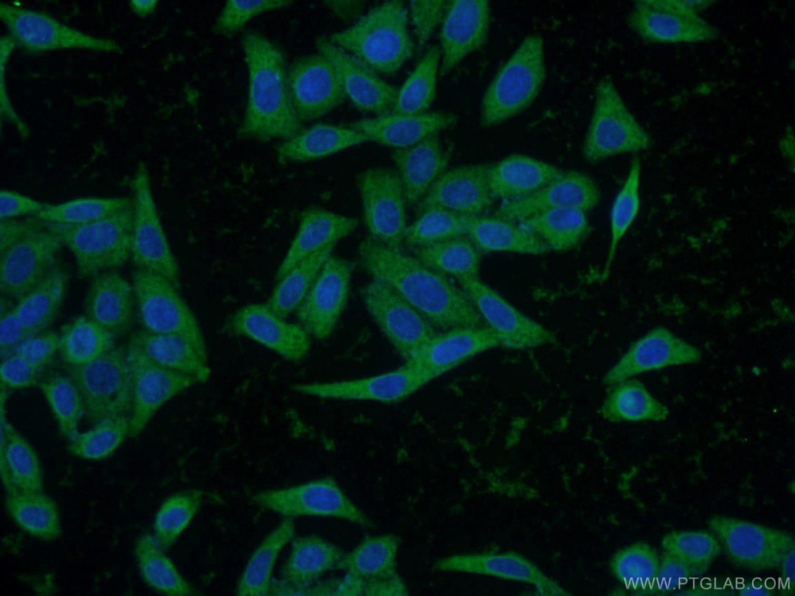 Immunofluorescence (IF) / fluorescent staining of HepG2 cells using INSIG2 Polyclonal antibody (24766-1-AP)