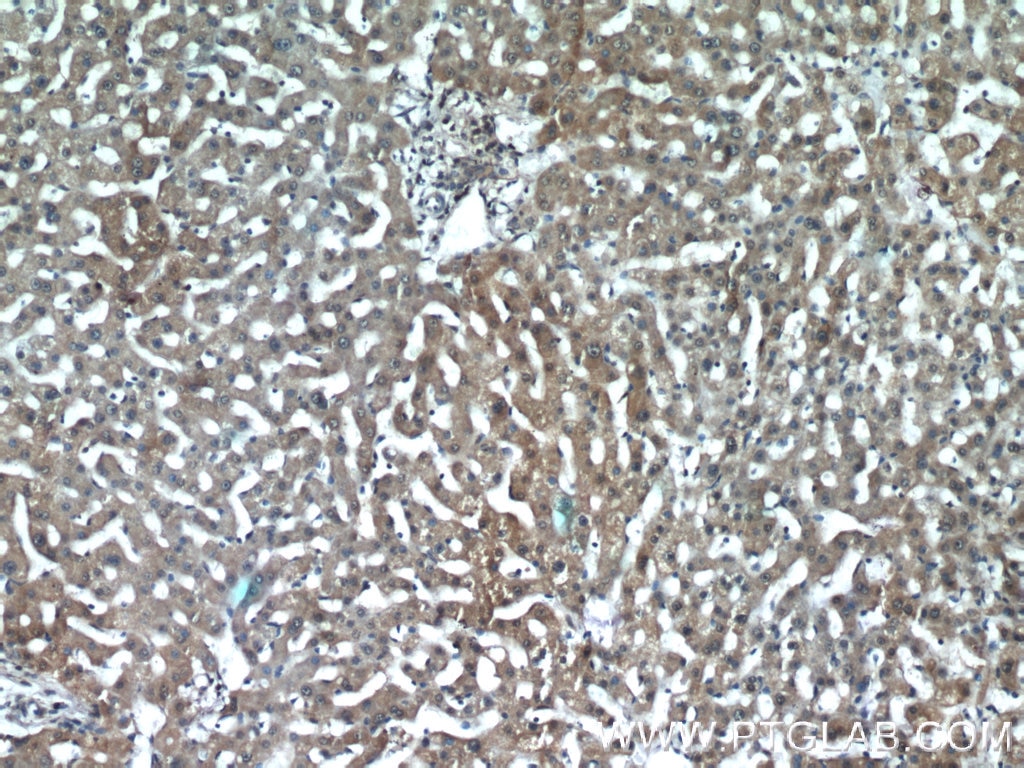 Immunohistochemistry (IHC) staining of human liver tissue using INSIG2 Polyclonal antibody (24766-1-AP)