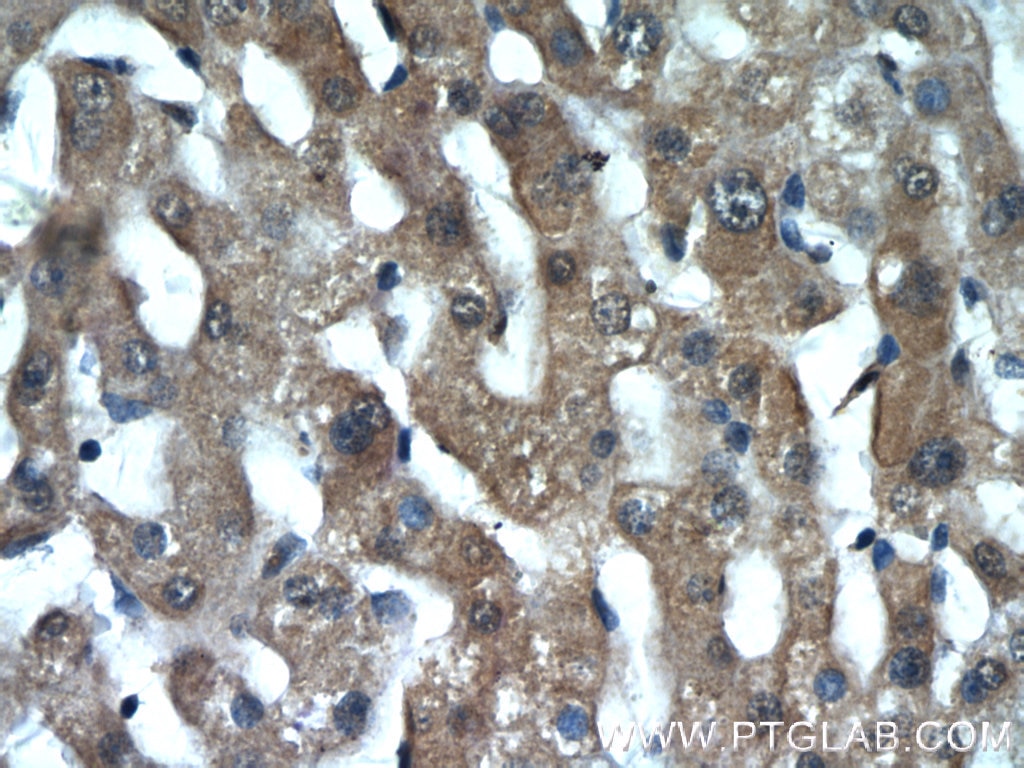 Immunohistochemistry (IHC) staining of human liver tissue using INSIG2 Polyclonal antibody (24766-1-AP)