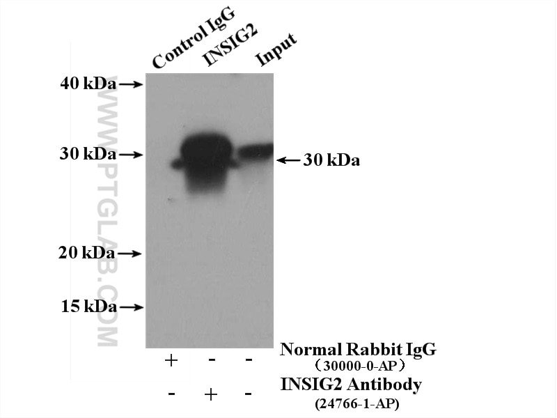 Immunoprecipitation (IP) experiment of mouse liver tissue using INSIG2 Polyclonal antibody (24766-1-AP)