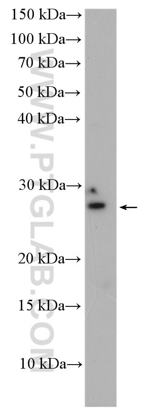 Western Blot (WB) analysis of A549 cells using INSIG2 Polyclonal antibody (24766-1-AP)