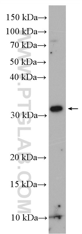 Western Blot (WB) analysis of SGC-7901 cells using INSIG2 Polyclonal antibody (24766-1-AP)