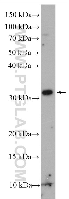 WB analysis of SGC-7901 using 24766-1-AP