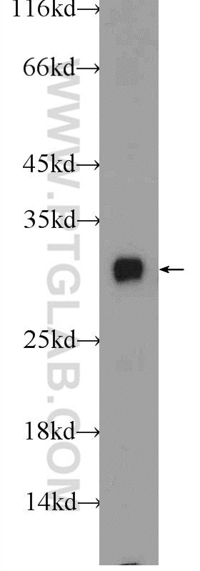 Western Blot (WB) analysis of rat liver tissue using INSIG2 Polyclonal antibody (24766-1-AP)