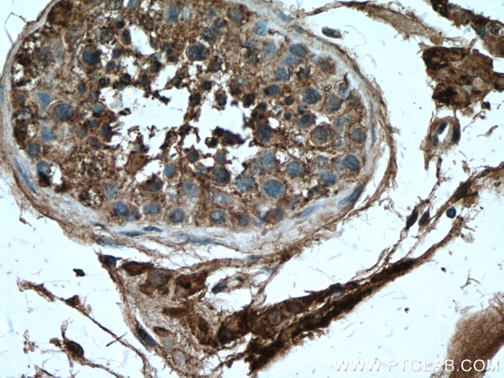 Immunohistochemistry (IHC) staining of human testis tissue using INSL3 Polyclonal antibody (17997-1-AP)