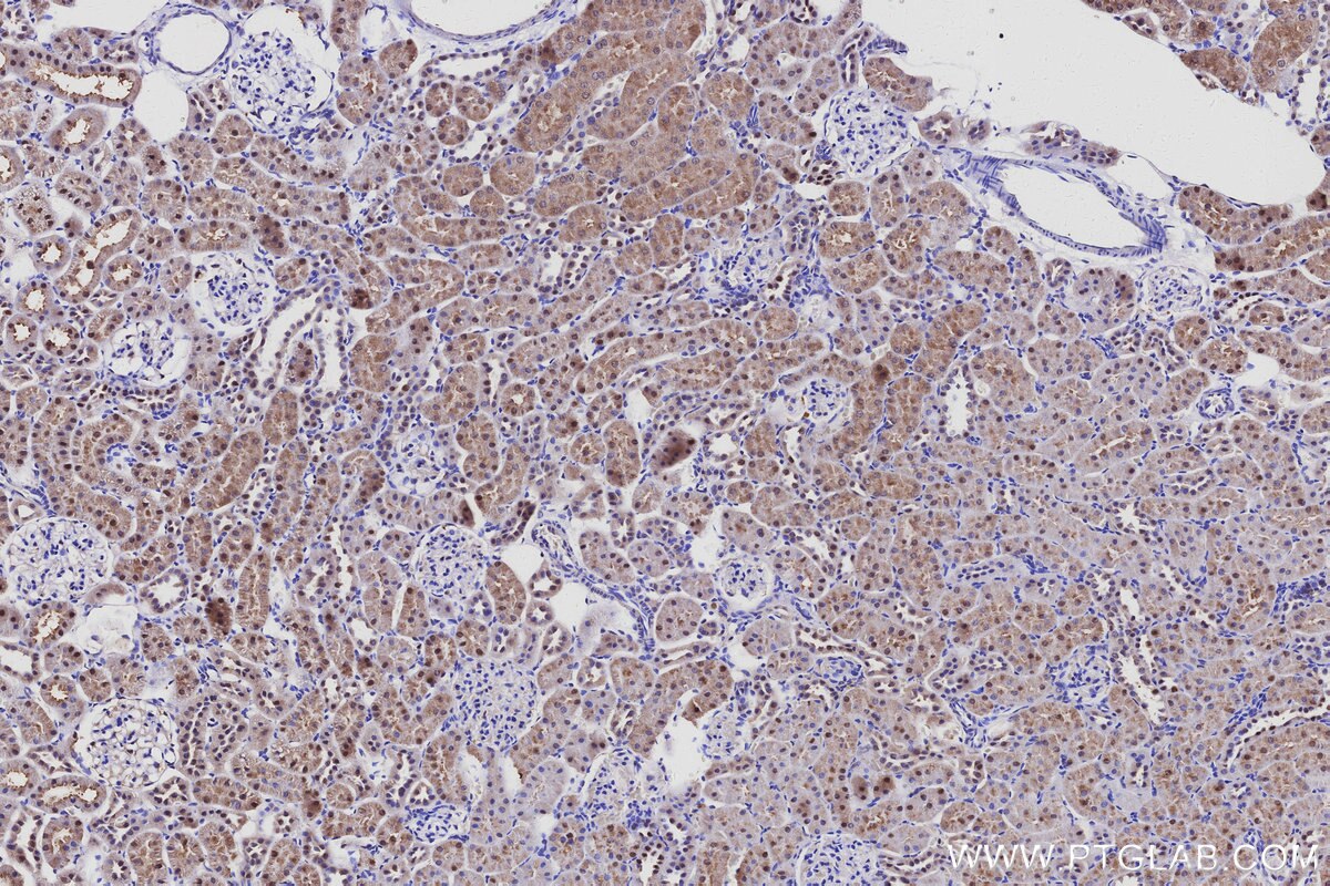 IHC staining of rat kidney using 33151-1-AP Immunohistochemistry (IHC) staining of rat kidney tissue using INSM2 Polyclonal antibody (33151-1-AP)