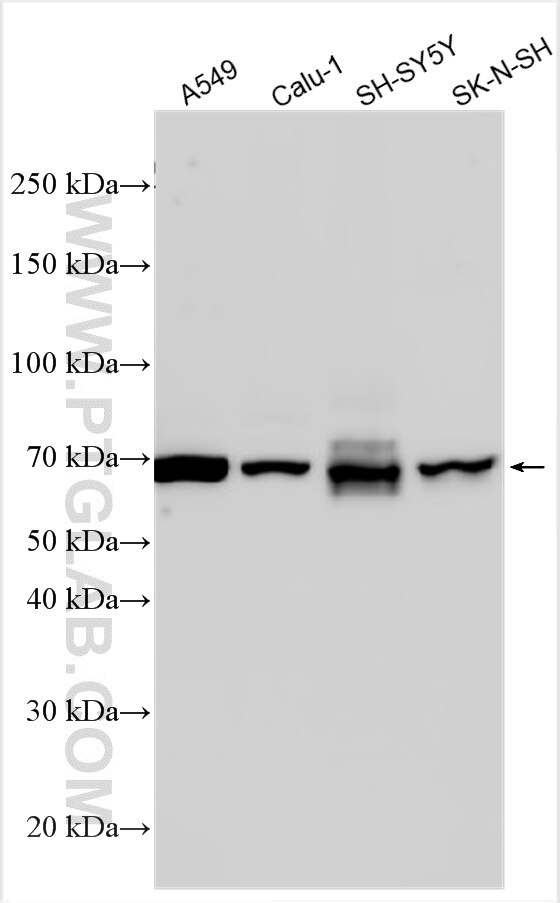 WB analysis using 33151-1-AP Western Blot (WB) analysis of various lysates using INSM2 Polyclonal antibody (33151-1-AP)