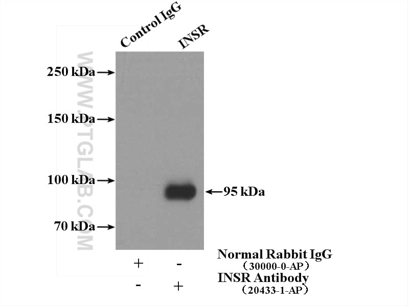 Immunoprecipitation (IP) experiment of HeLa cells using INSR Polyclonal antibody (20433-1-AP)