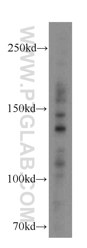 Western Blot (WB) analysis of HT-1080 cells using INSR Polyclonal antibody (20433-1-AP)