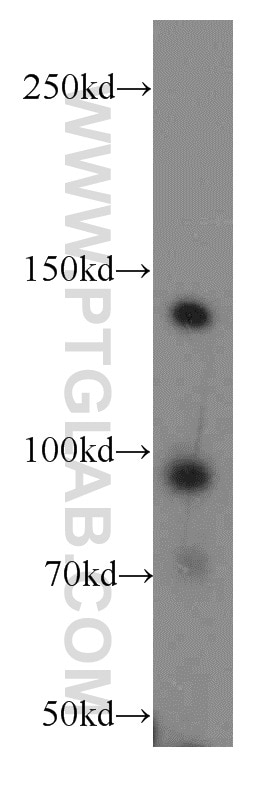 Western Blot (WB) analysis of MCF-7 cells using INSR Polyclonal antibody (20433-1-AP)