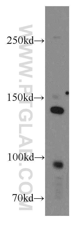 Western Blot (WB) analysis of HeLa cells using INSR Polyclonal antibody (20433-1-AP)