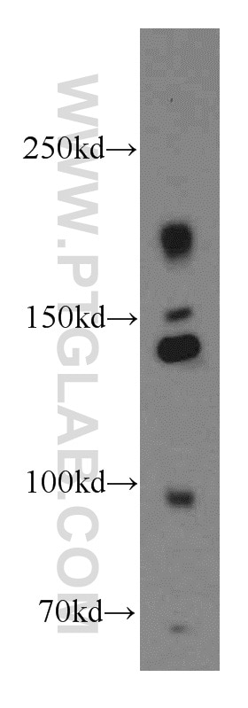 Western Blot (WB) analysis of HEK-293 cells using INSR Polyclonal antibody (20433-1-AP)