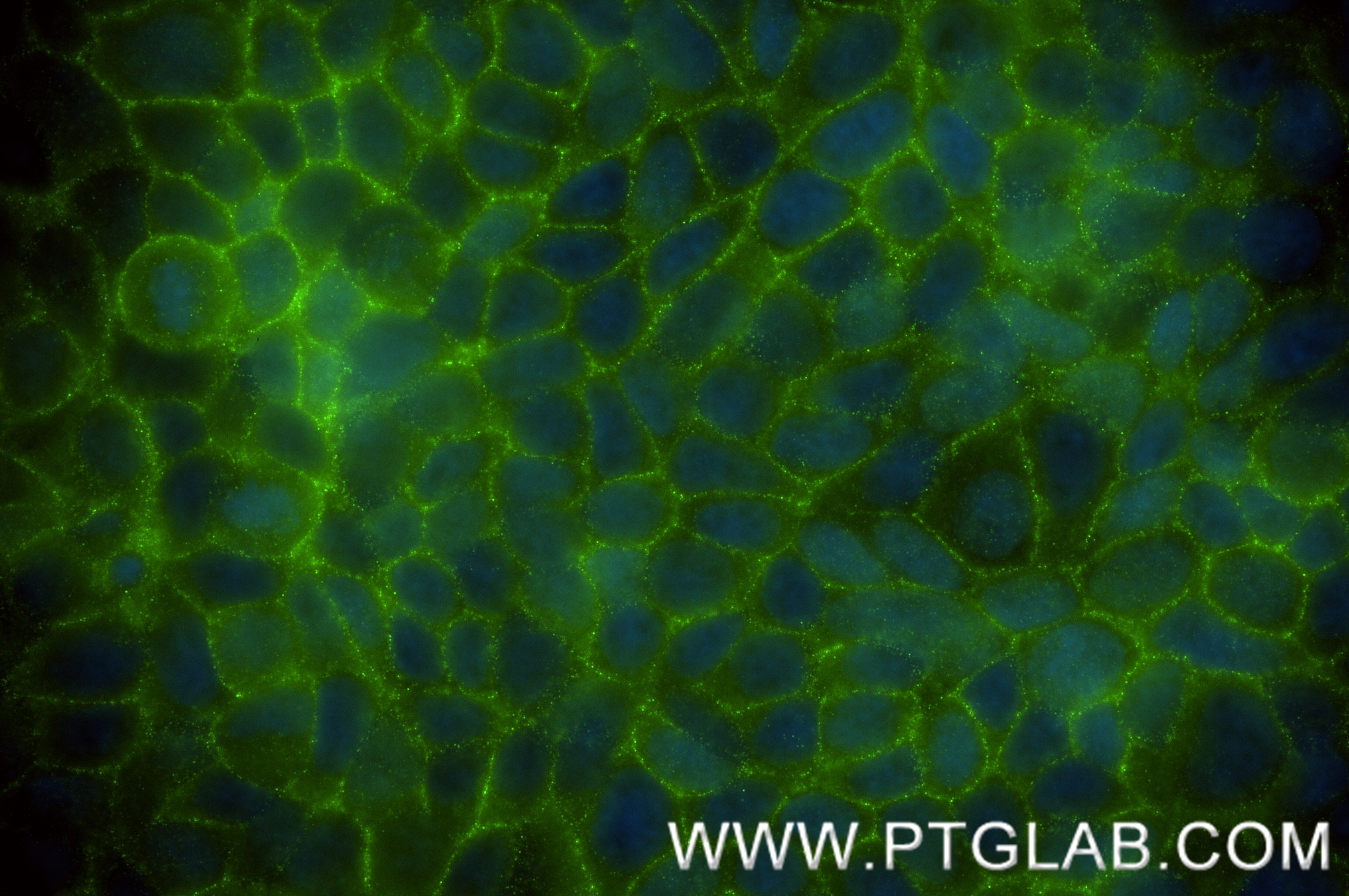 Immunofluorescence (IF) / fluorescent staining of MCF-7 cells using INSR/CD220 Recombinant antibody (84467-2-RR)