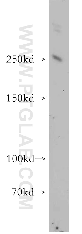 Western Blot (WB) analysis of human brain tissue using INSRR Polyclonal antibody (55112-1-AP)