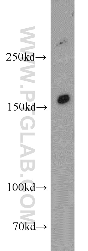 Western Blot (WB) analysis of mouse kidney tissue using INSRR Polyclonal antibody (55112-1-AP)
