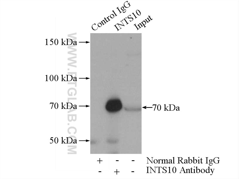 Immunoprecipitation (IP) experiment of HeLa cells using INTS10 Polyclonal antibody (15271-1-AP)
