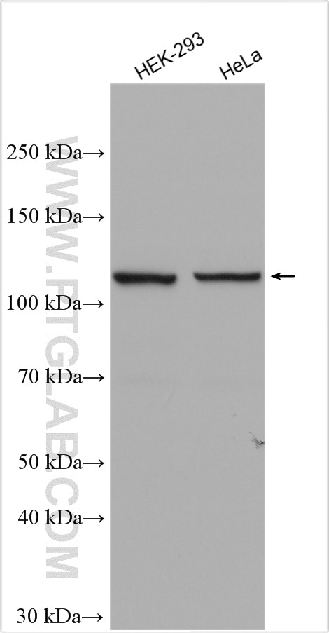 Western Blot (WB) analysis of various lysates using INTS3 Polyclonal antibody (16620-1-AP)