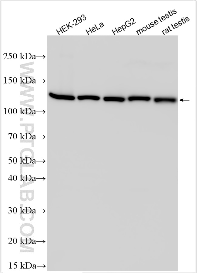 Western Blot (WB) analysis of various lysates using INTS3 Polyclonal antibody (16620-1-AP)